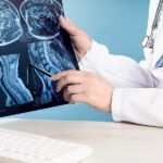Female Doctors Hand Pointing At X-ray Medical Imaging At A Shoul